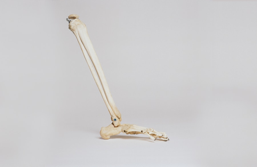 A skeleton of a leg with a bone sticking out of it.